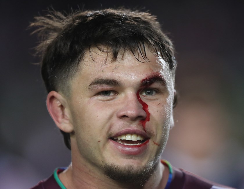 Battle scars....Zac Fulton after his memorable NRL debut at 4 Pines Park